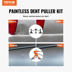 Bilkrop Dent Puller Bridge Lenter Tool Maintless Hail Remover Repair Kit