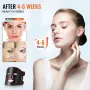 Red Light Therapy for Face, Red Light Therapy Mask with 3 Wavelengths and 3 Intensity Levels, LED Face Mask Light Therapy, Porta